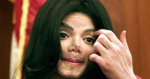 Michael Jackson hanya operasi plastik 2 kali dalam hidupnya